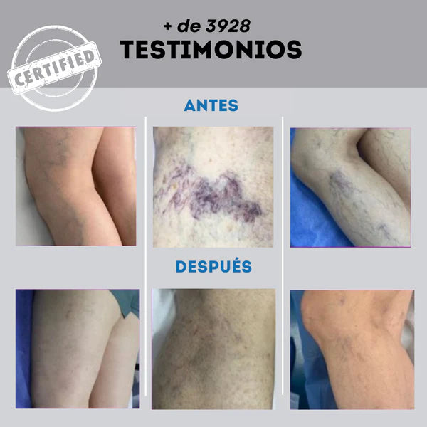 Spray para Piernas – Alivia Cansancio – Sensación Ligera en 5 Minutos