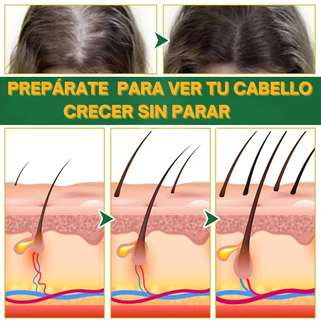 PACK ACEITE TRATAMIENTO CAPILAR NUTRITIVO ANTICAÍDA - Activa el crecimiento – Cabello más fuerte y grueso desde la raíz