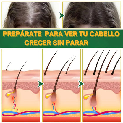 PACK ACEITE TRATAMIENTO CAPILAR NUTRITIVO ANTICAÍDA - Activa el crecimiento – Cabello más fuerte y grueso desde la raíz